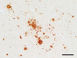 Corte histológico de tecido nervoso com vacuolização