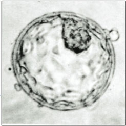 Micrografia de um blastocisto humano